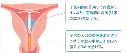 子宮内膜に作用して内膜がうすくなり、受精卵の着床（妊娠の成立）を妨げる